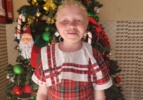 Adopcia detí s albinizmom